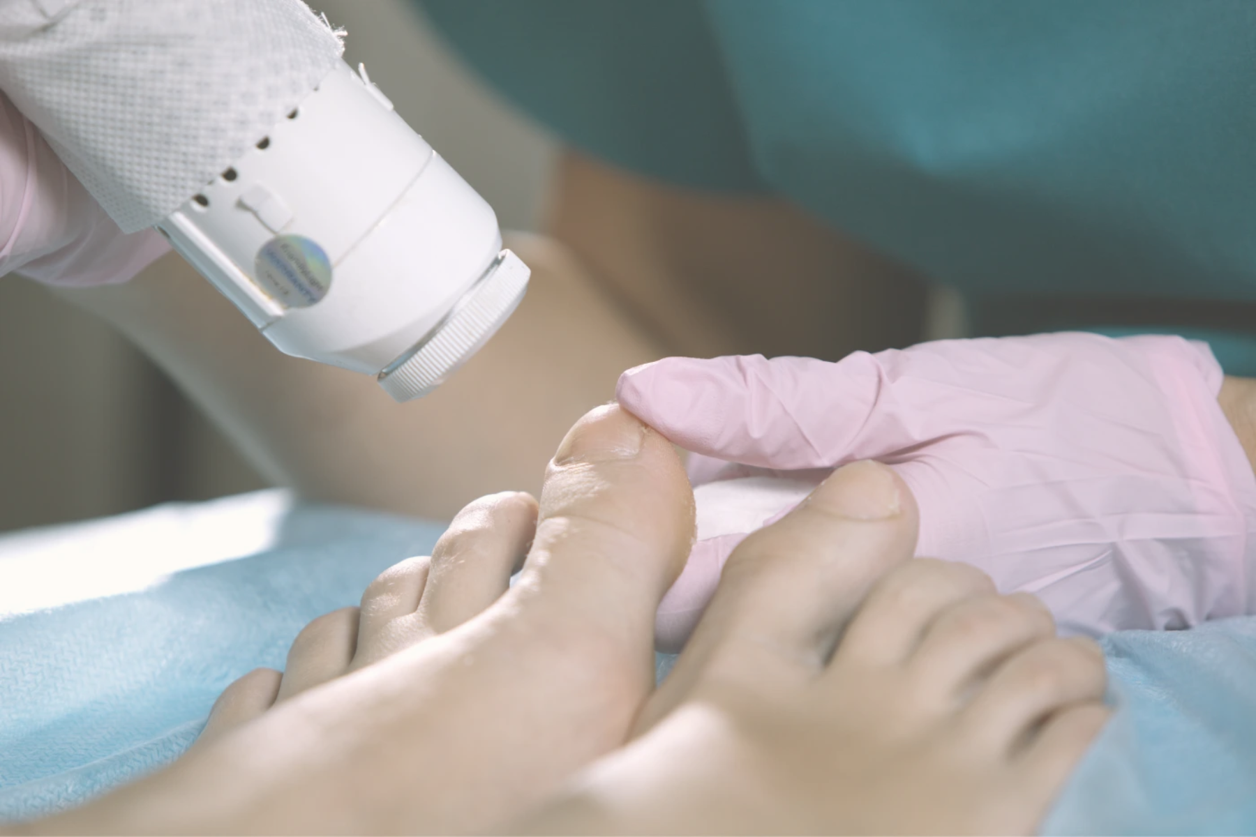 Laser Treatment | Elegant Clinic
