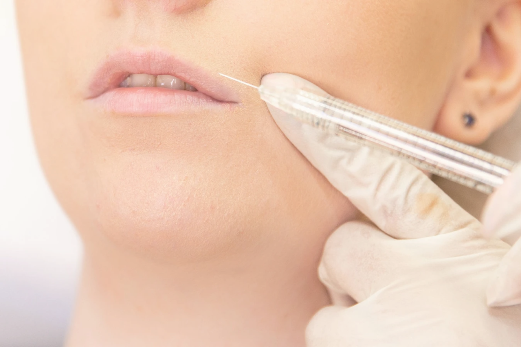 Botox Injections | Elegant Clinic Botox Injections | Elegant Clinic