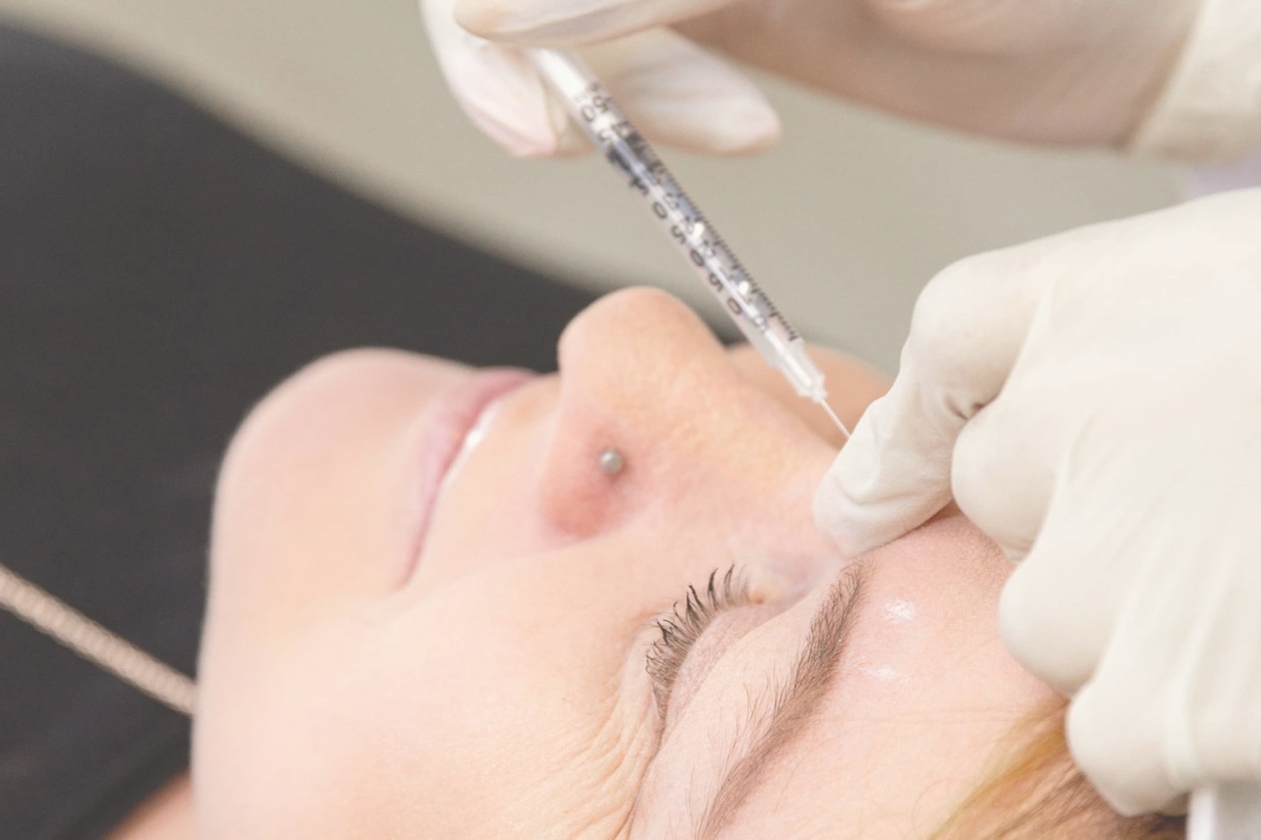 Botox Skin Treatments Bournemouth | Elegant Clinic Botox Skin Treatments Bournemouth | Elegant Clinic