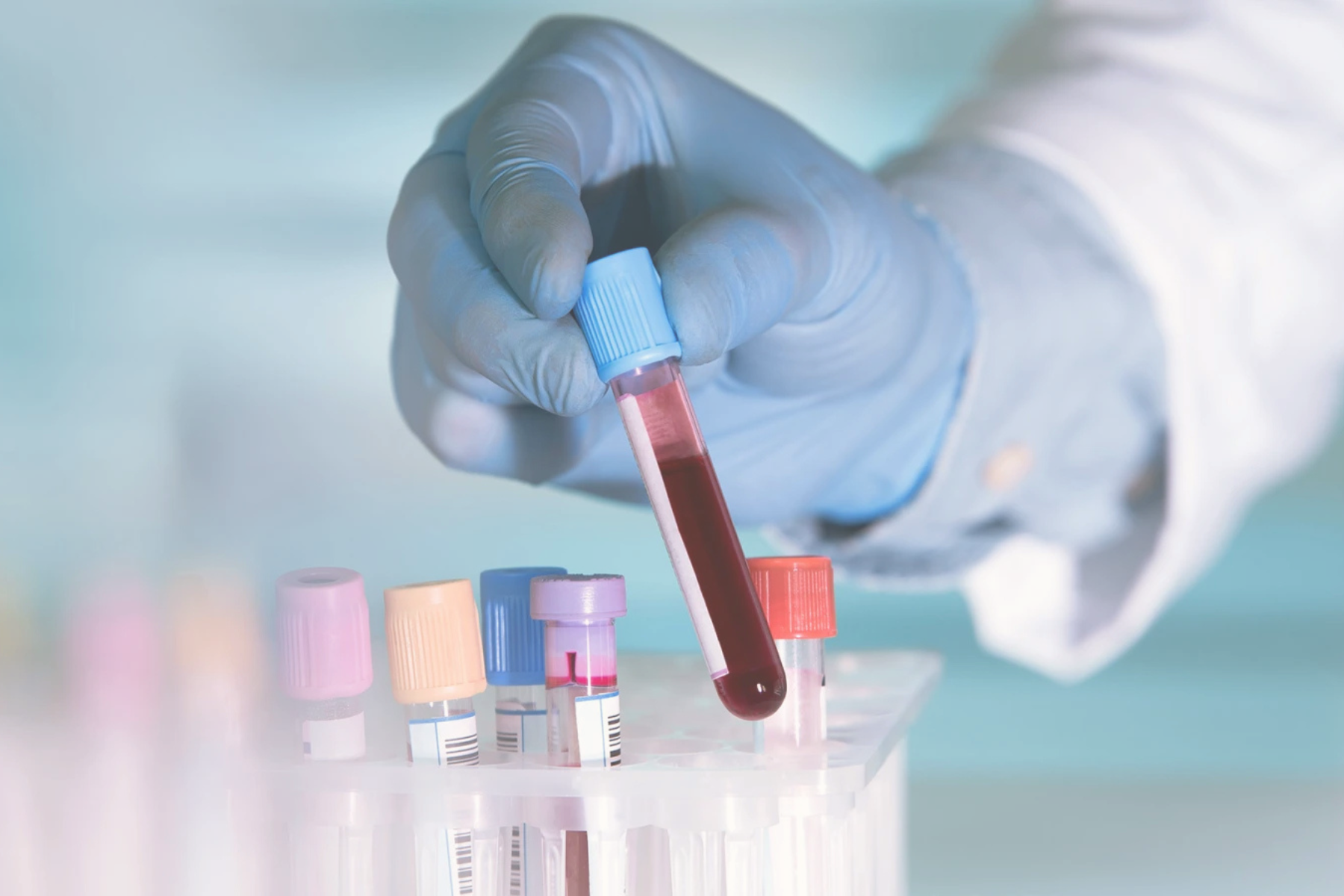 Private Blood Tests Sandbanks | Elegant Clinic Private Blood Tests Sandbanks | Elegant Clinic