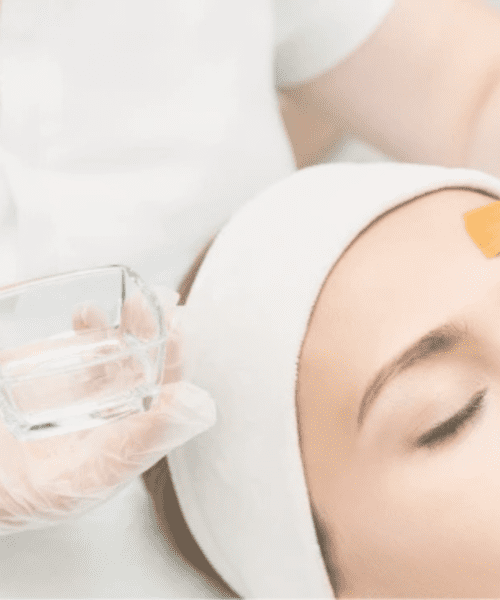 Stimulator Peel Treatments Poole | Elegant Clinic