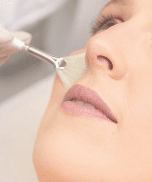 Zo Skin Peel Treatments Poole | Elegant Clinic