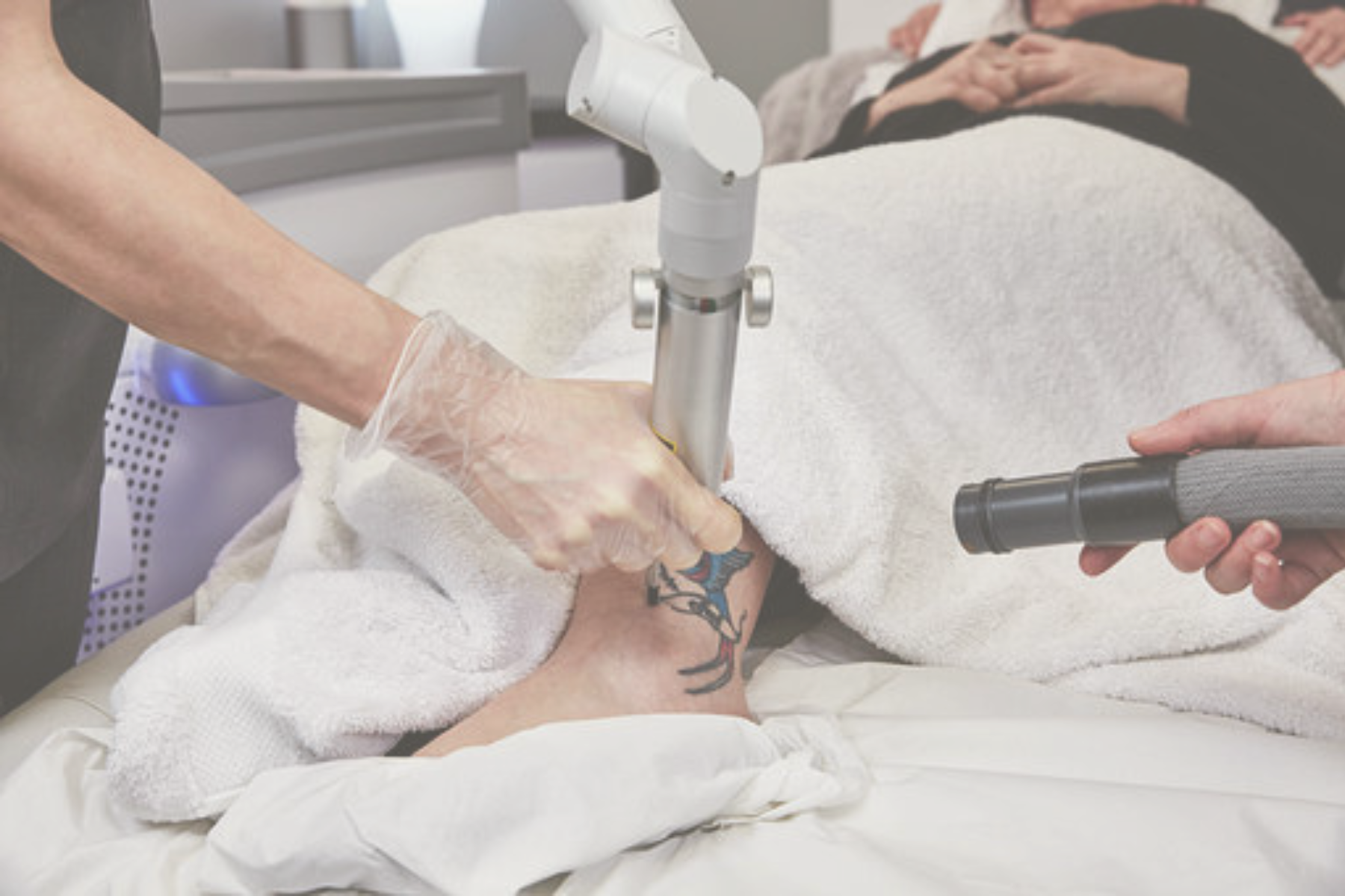 Tattoo Removal | Elegant Clinic